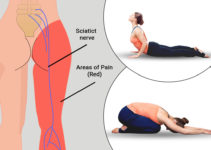 Yoga for Sciatica: 10 Best Yoga Poses To Relief From Sciatica Pain Yoga for Sciatica: 10 Best Yoga Poses To Relief From Sciatica Pain